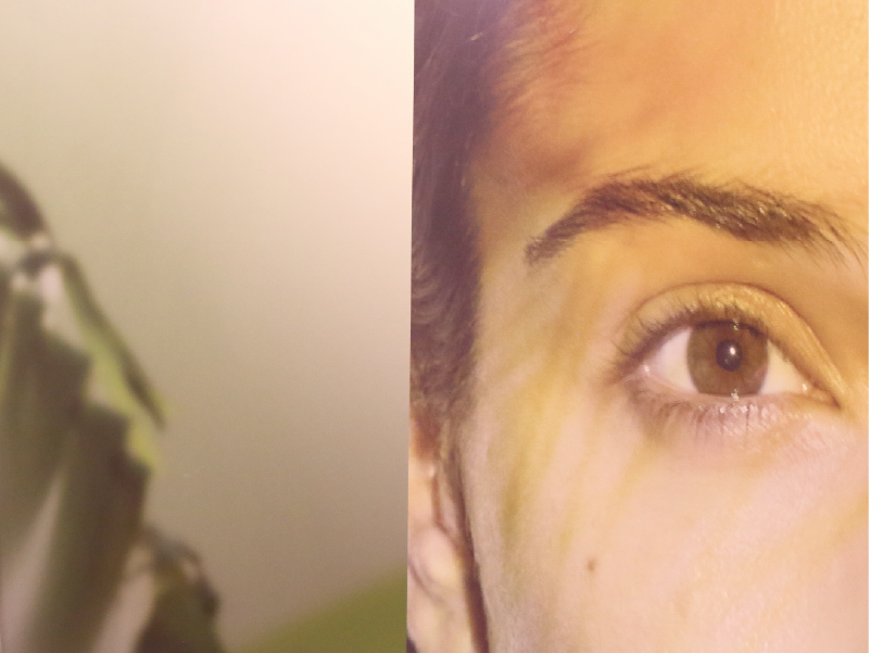 Botox® Berlin | Ihr Termin bei Myskin