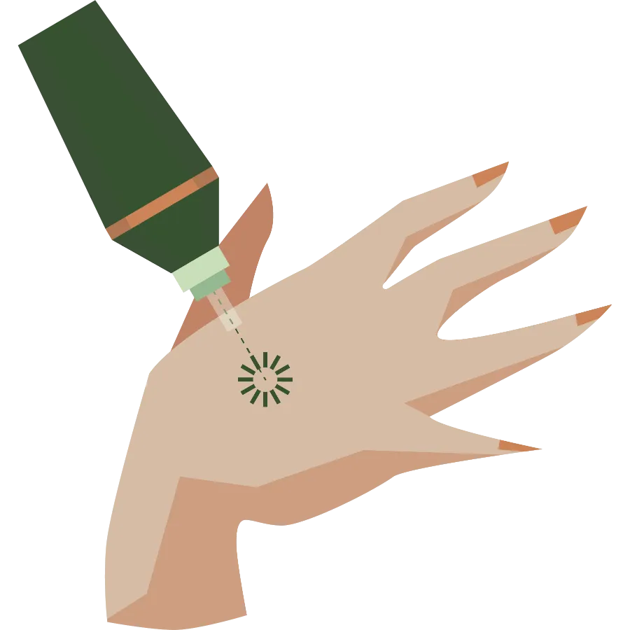 Laserbehandlung Berlin | Ihr Termin bei Myskin