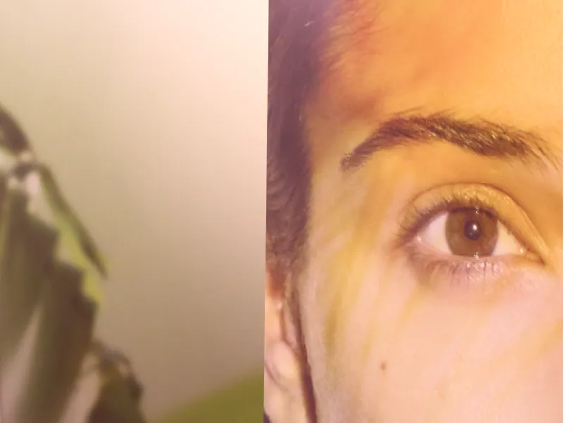 Botox-Behandlung in Berlin bei Dr. Pettker